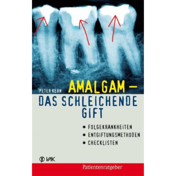 VAK Amalgam – das schleichende Gift